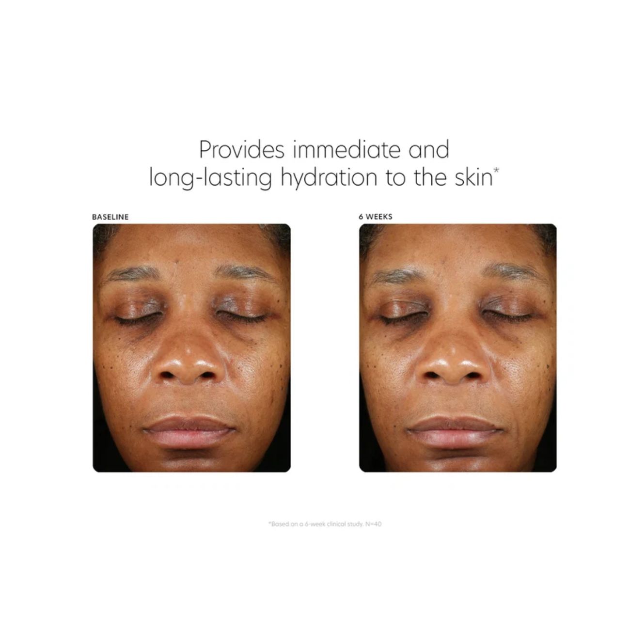 PCA Skin Hyaluronic Acid Boosting Serum
