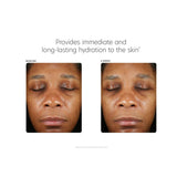PCA Skin Hyaluronic Acid Boosting Serum