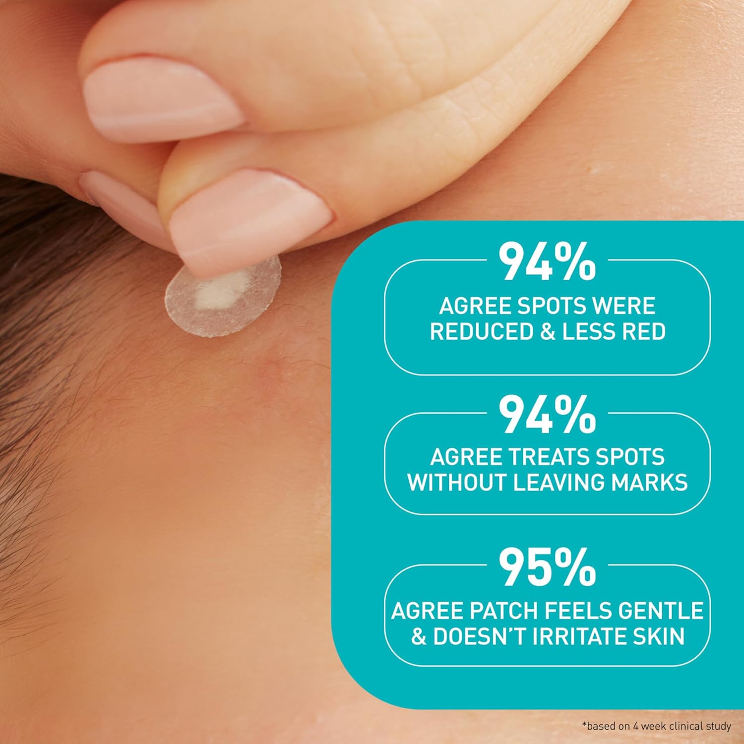 Blemish Barrier Patches With 3 Essential Ceramides and Niacinamide, 22pcs