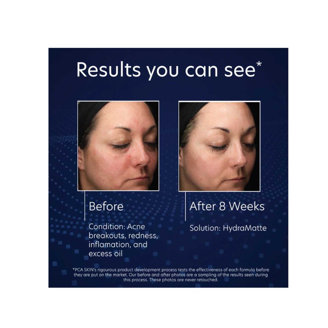 PCA Skin Hydramatte Oil Controlling
