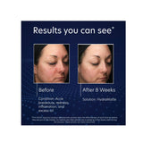 PCA Skin Hydramatte Oil Controlling