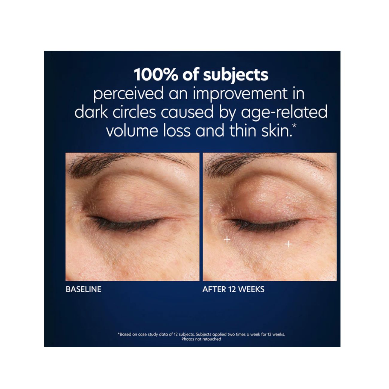 PCA Skin Hyaluronic Acid Microneedle Eye Patches