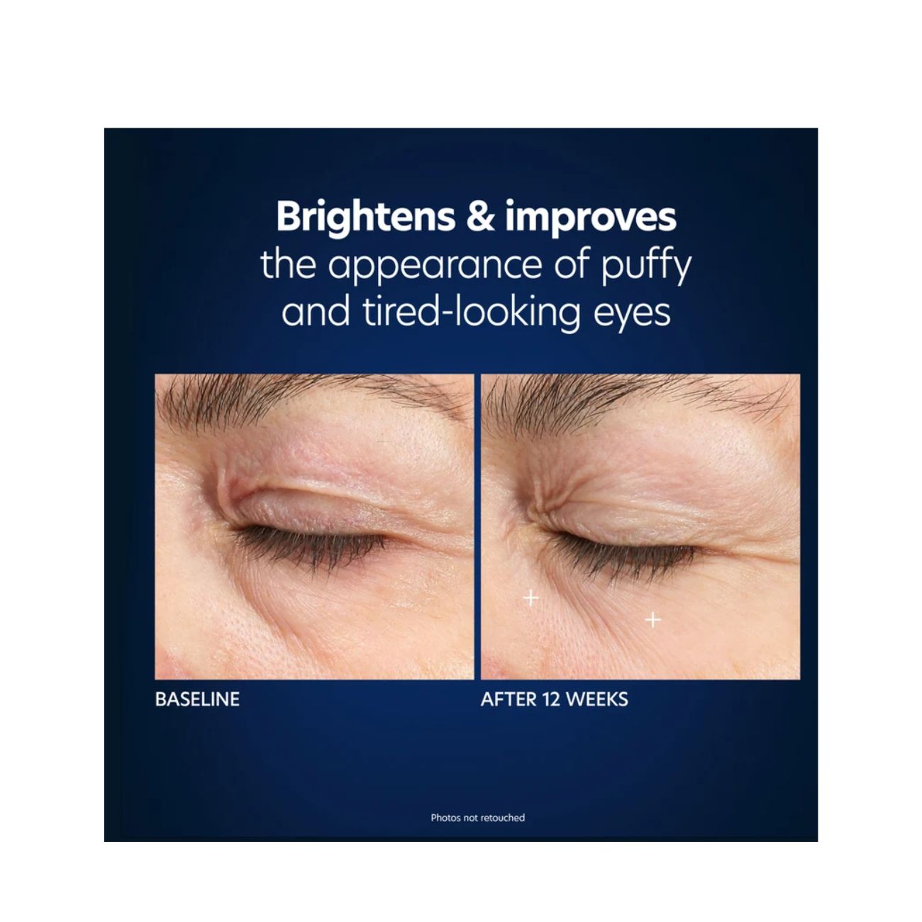 PCA Skin Hyaluronic Acid Microneedle Eye Patches