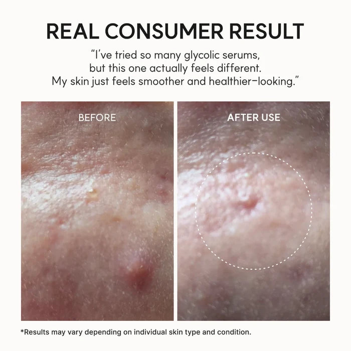 Eraser Shot Glycolic Acid Booster Blemish Control And Soothing Exfoliator