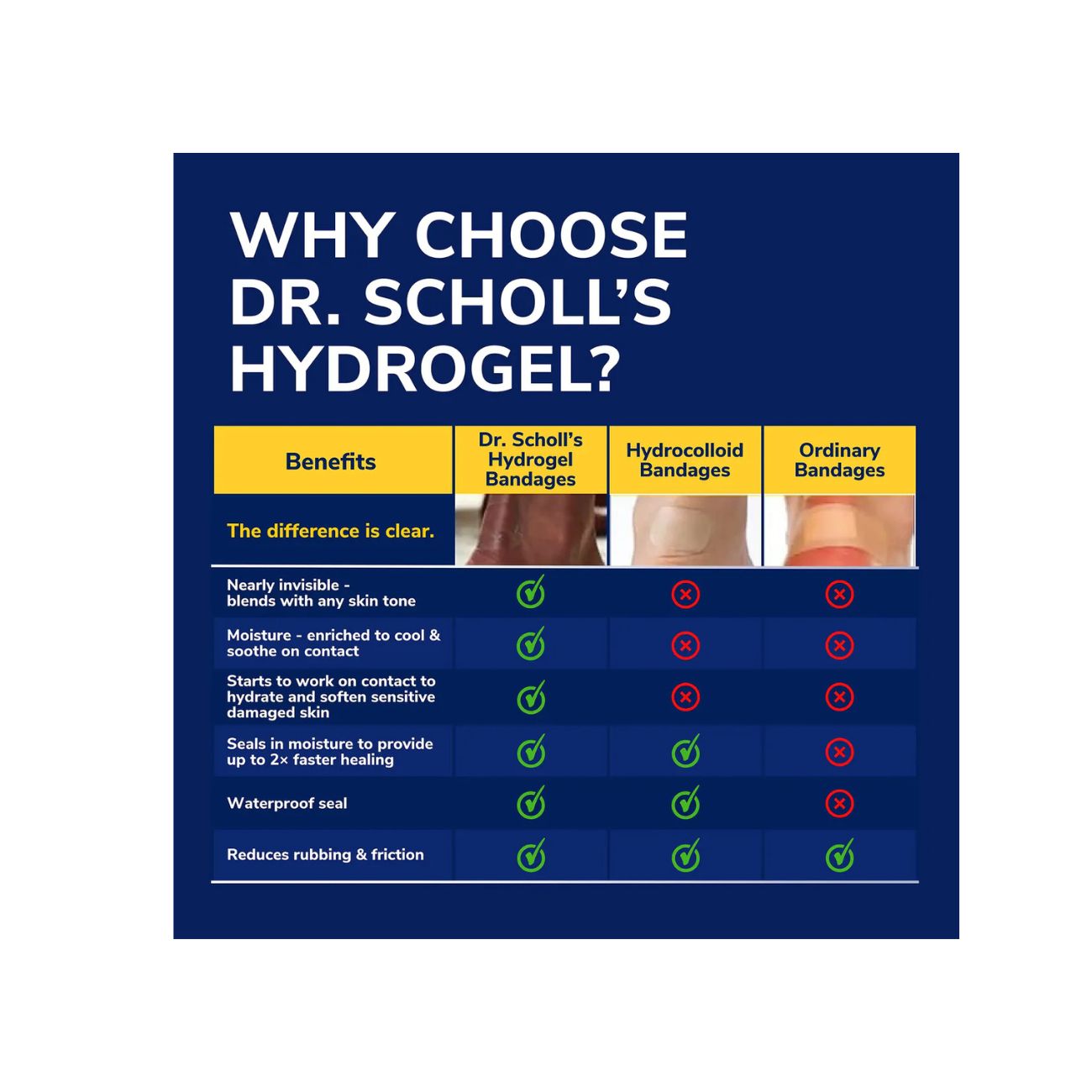Callus Cushions Hydrogel