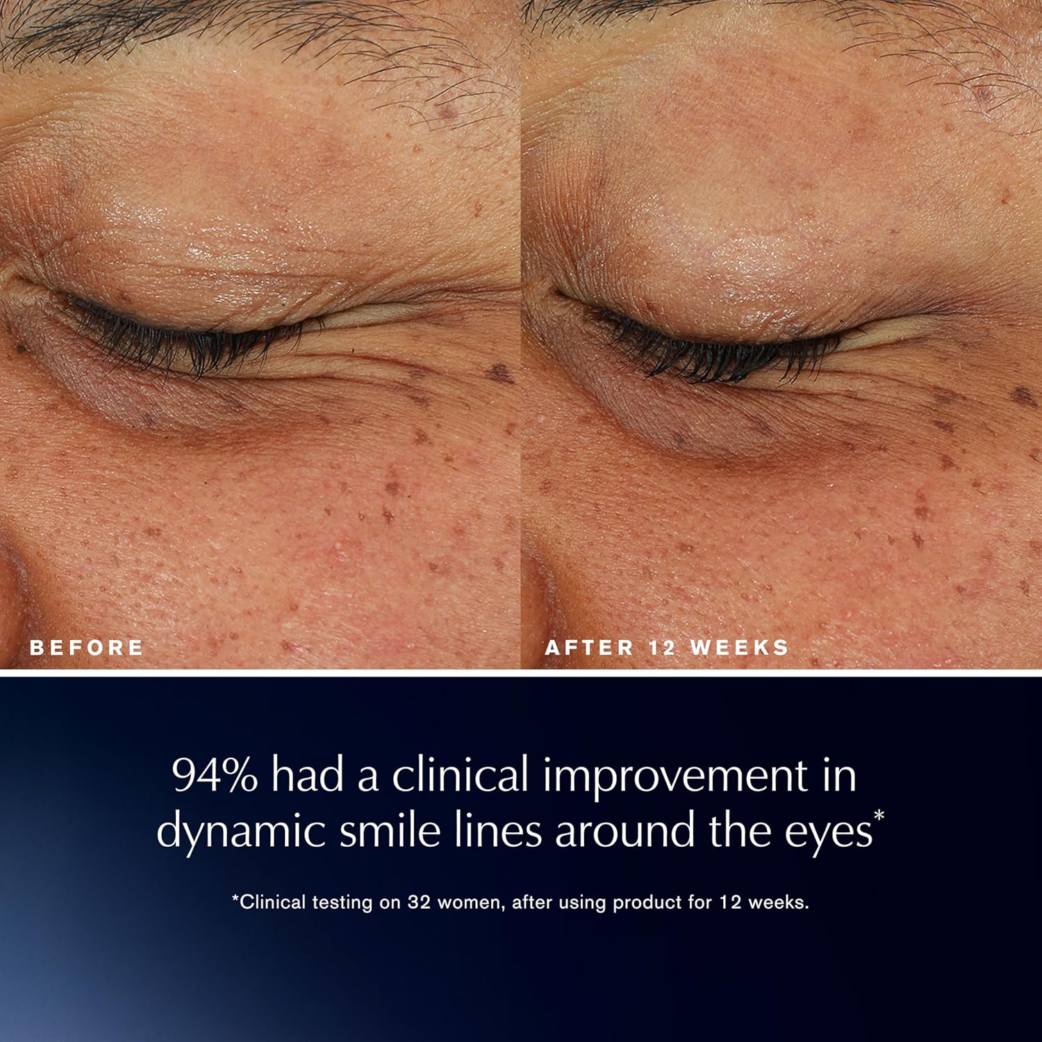 Advanced Night Repair Eye Lift + Sculpt
