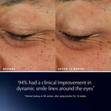 Advanced Night Repair Eye Lift + Sculpt