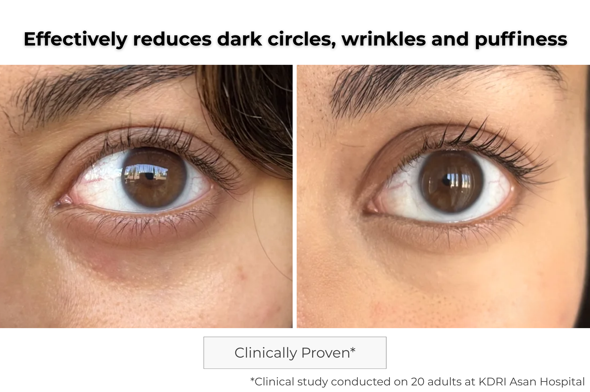 Microneedling Eye Patch