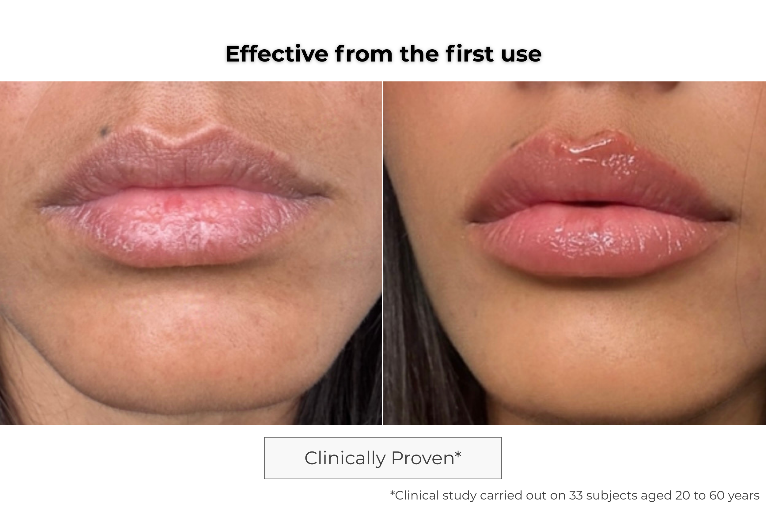 Microneedling Lip Patch