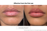 Microneedling Lip Patch
