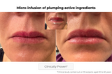 Microneedling Lip Patch