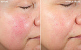 Probio Balance® Face Cream