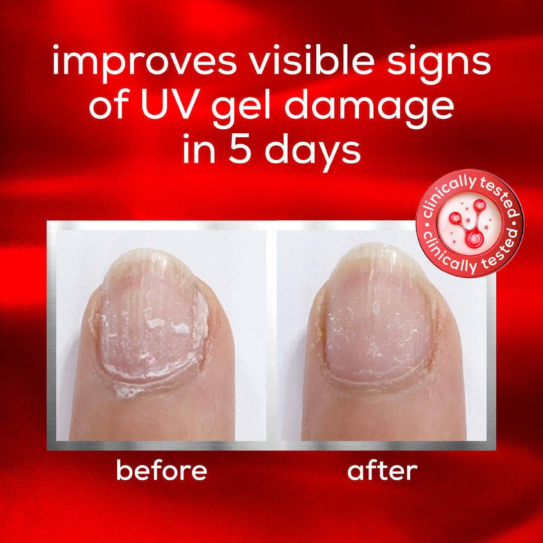 To The Rescue UV Gel Damage