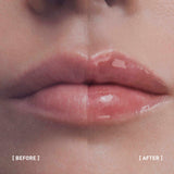 Hyalu Filler Lips