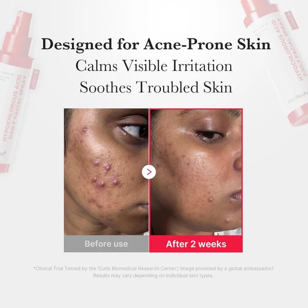 Hypochlorous Acid Daily Facial Spray