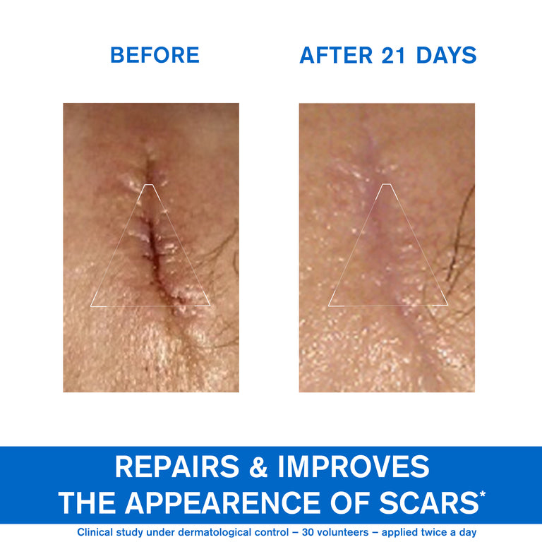 Bariéderm Cica-Cream with Copper-Zinc - Weakened Irritated Skin