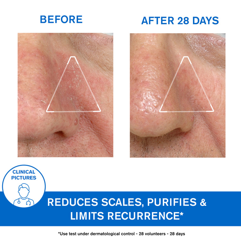 DS Regulating Soothing Emulsion - Skin Prone to Irritations Redness and Scales