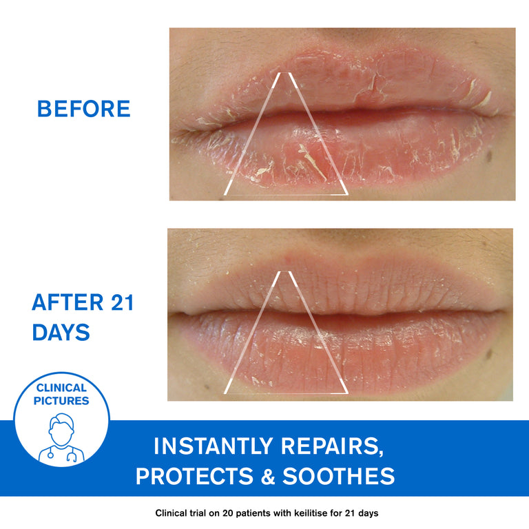 DS Regulating Soothing Emulsion - Skin Prone to Irritations Redness and Scales