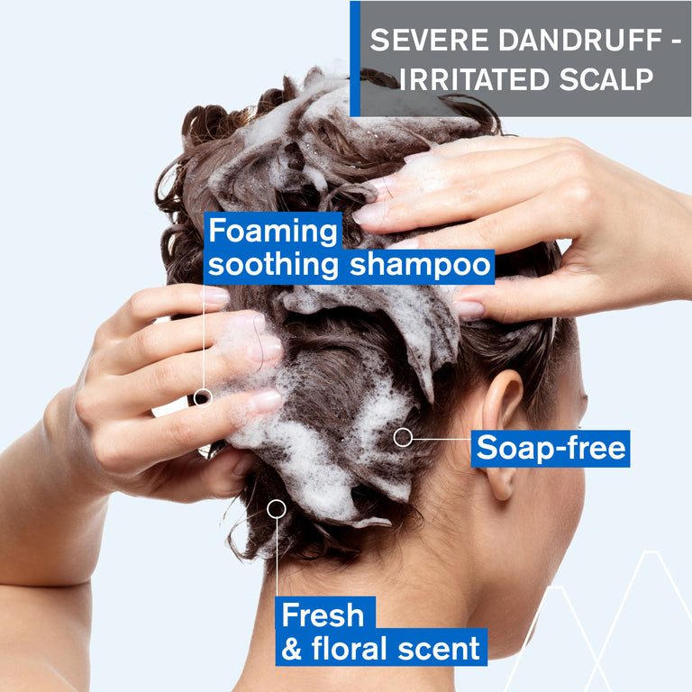 DS Hair Kerato-Reducing Treatment Shampoo - Severe Dandruff & Scaly Conditions