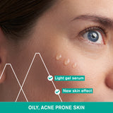 Hyséac - New Skin Serum