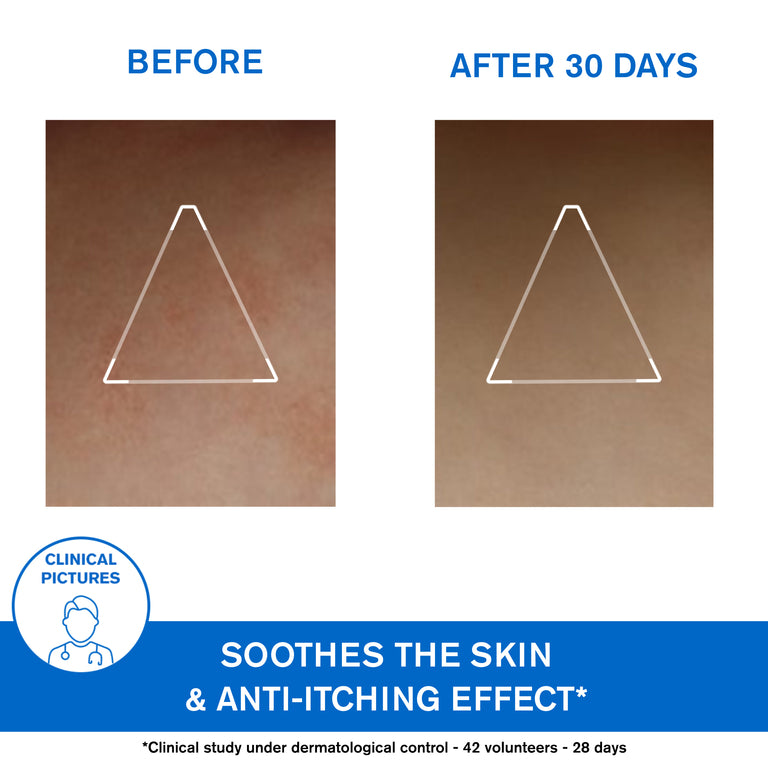 Xémose Lipid-Replenishing Anti-Irritation Cerat - Extreme Skin Dryness - Skin Prone to Atopy