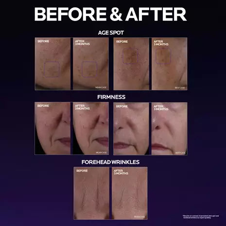 Mela B3 Double Dose Day & Night Intensive Treatment