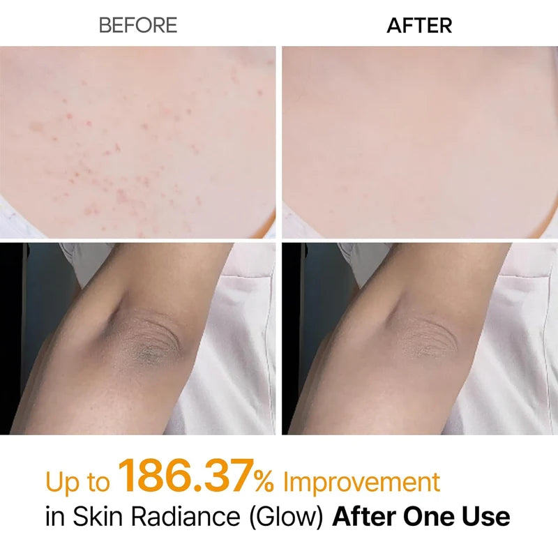 Peel Shot Exfoliating Kojic Acid Turmeric Spray Serum