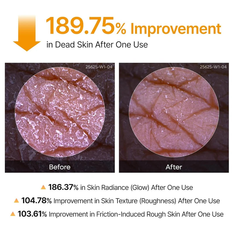 Peel Shot Exfoliating Kojic Acid Turmeric Spray Serum