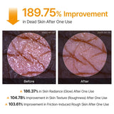 Peel Shot Exfoliating Kojic Acid Turmeric Spray Serum