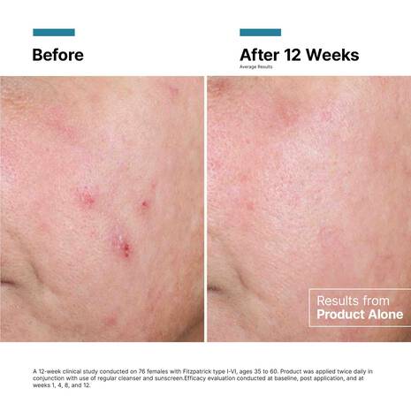 Advanced RGN-6 Regenerative Cream