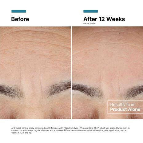 Advanced RGN-6 Regenerative Cream