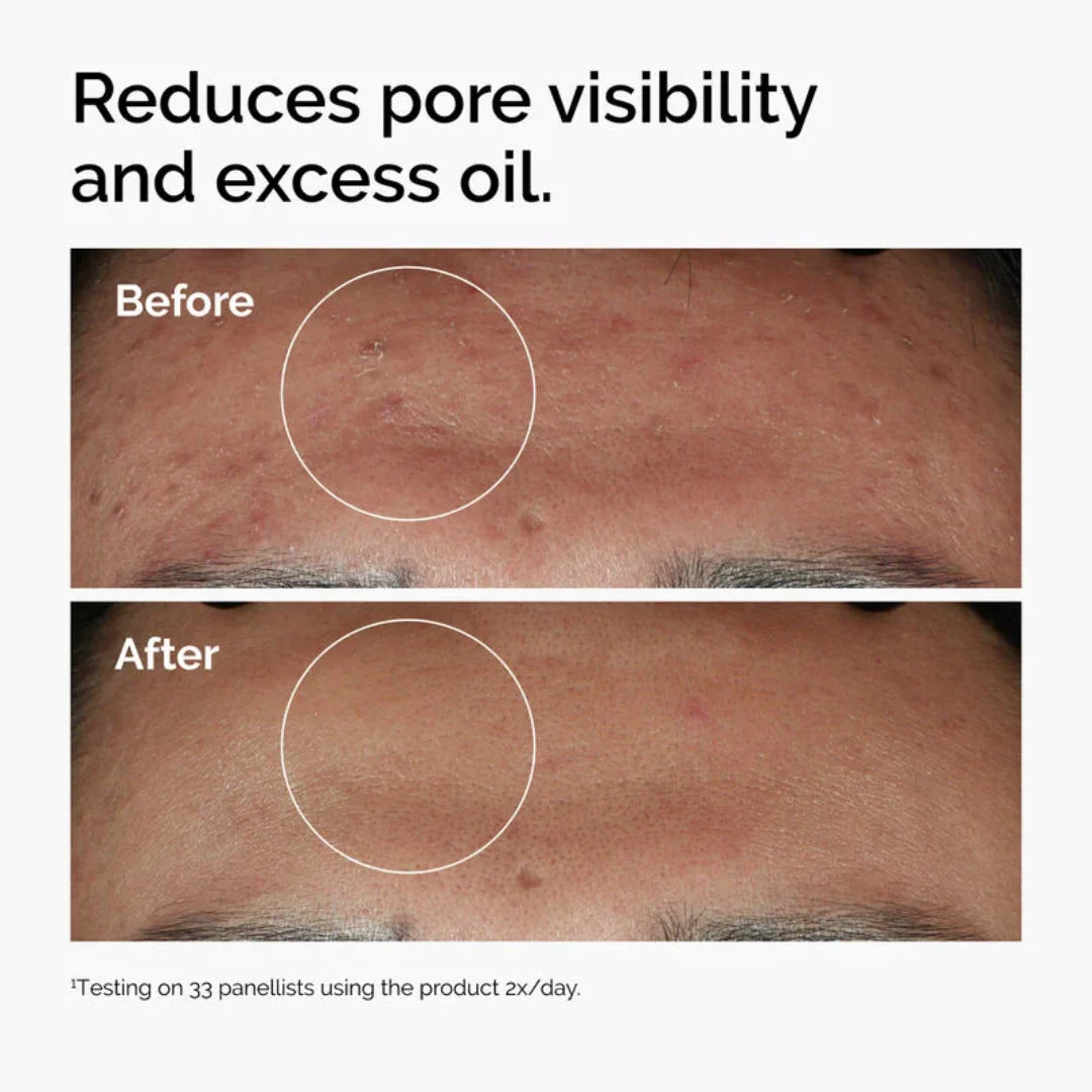 Niacinamide 10% + Zinc 1% Serum
