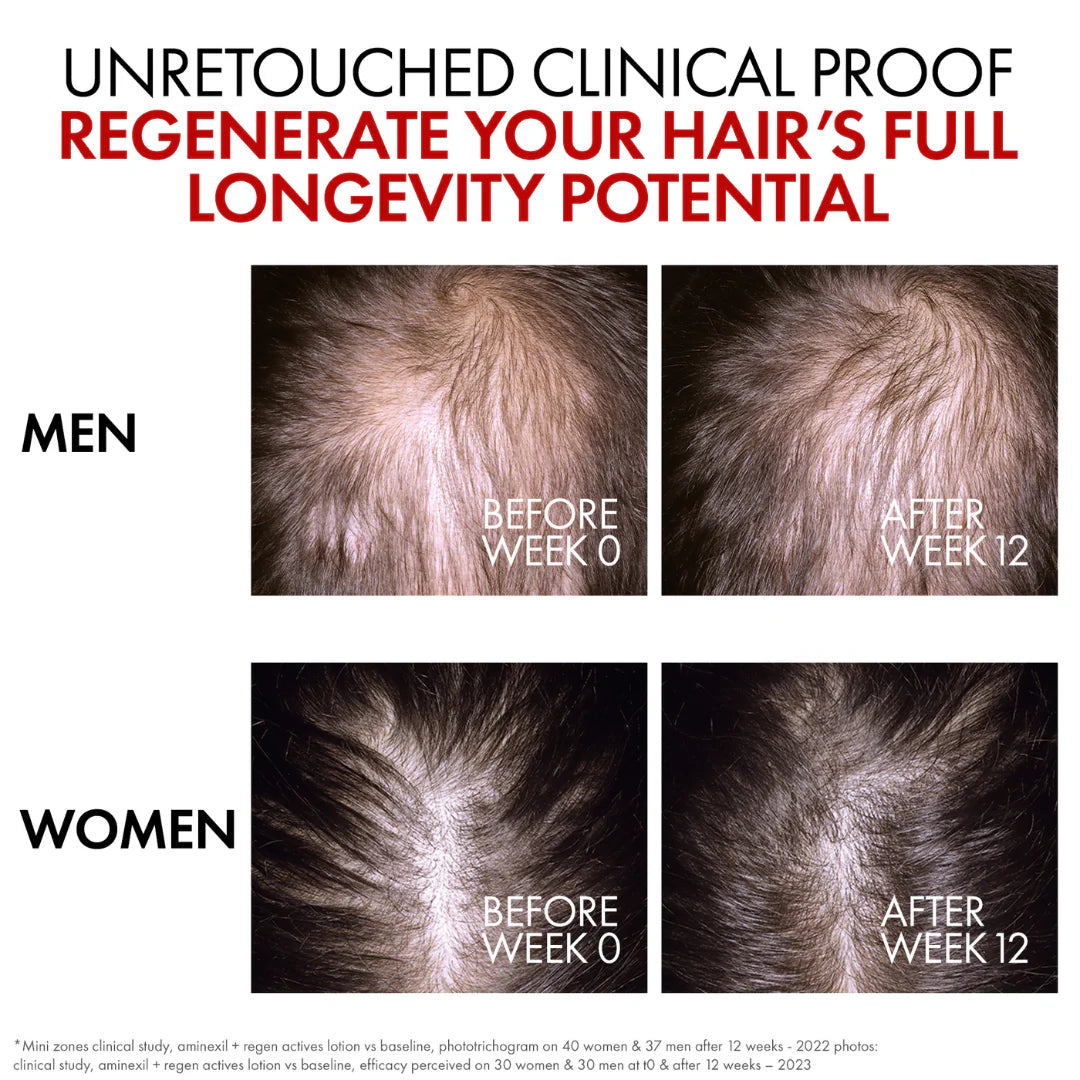 Aminexil Clinical R.E.G.E.N. Hair Renewing Serum +14,000 Hairs