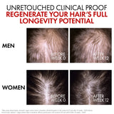 Aminexil Clinical R.E.G.E.N. Hair Renewing Serum +14,000 Hairs