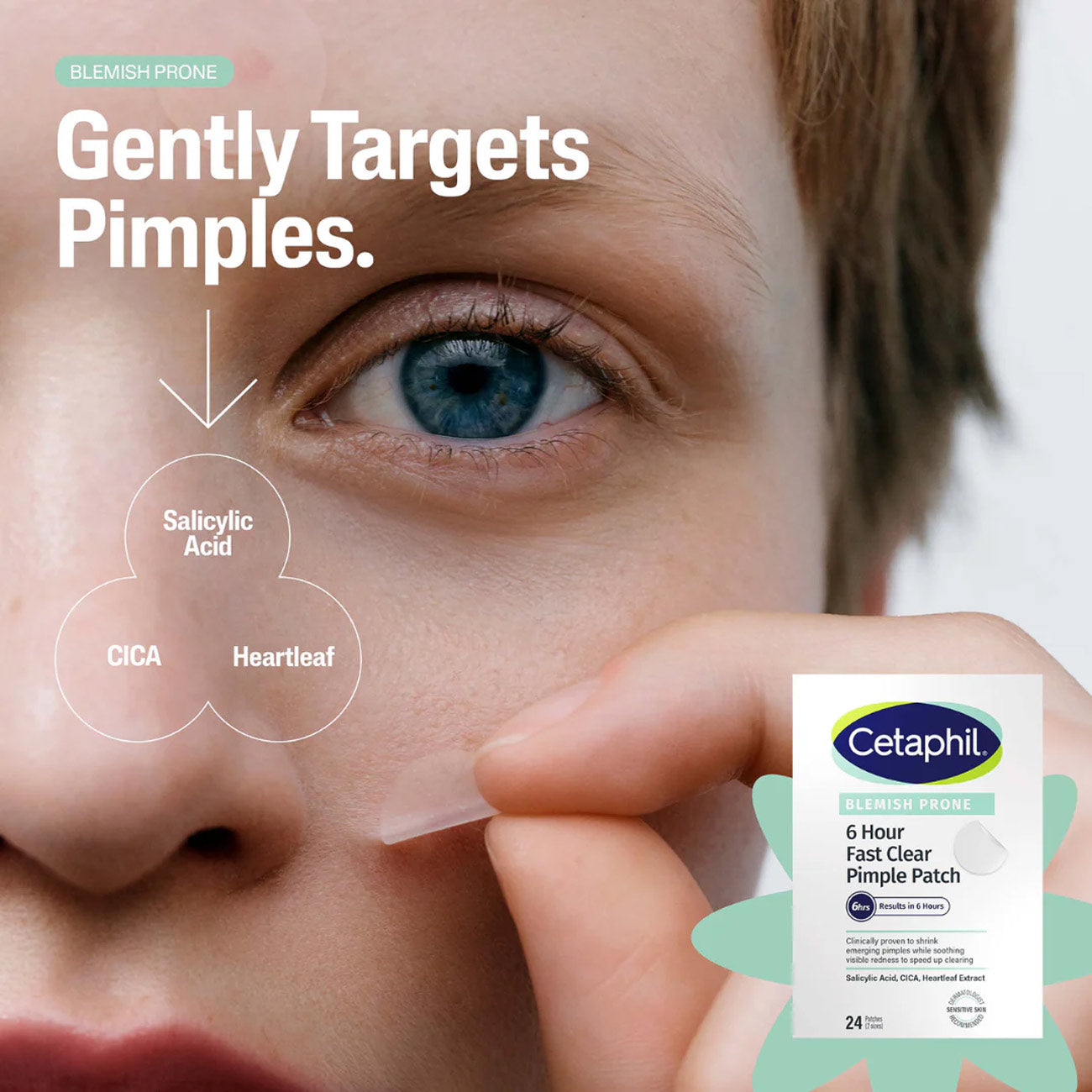 Pimple Clear Patches