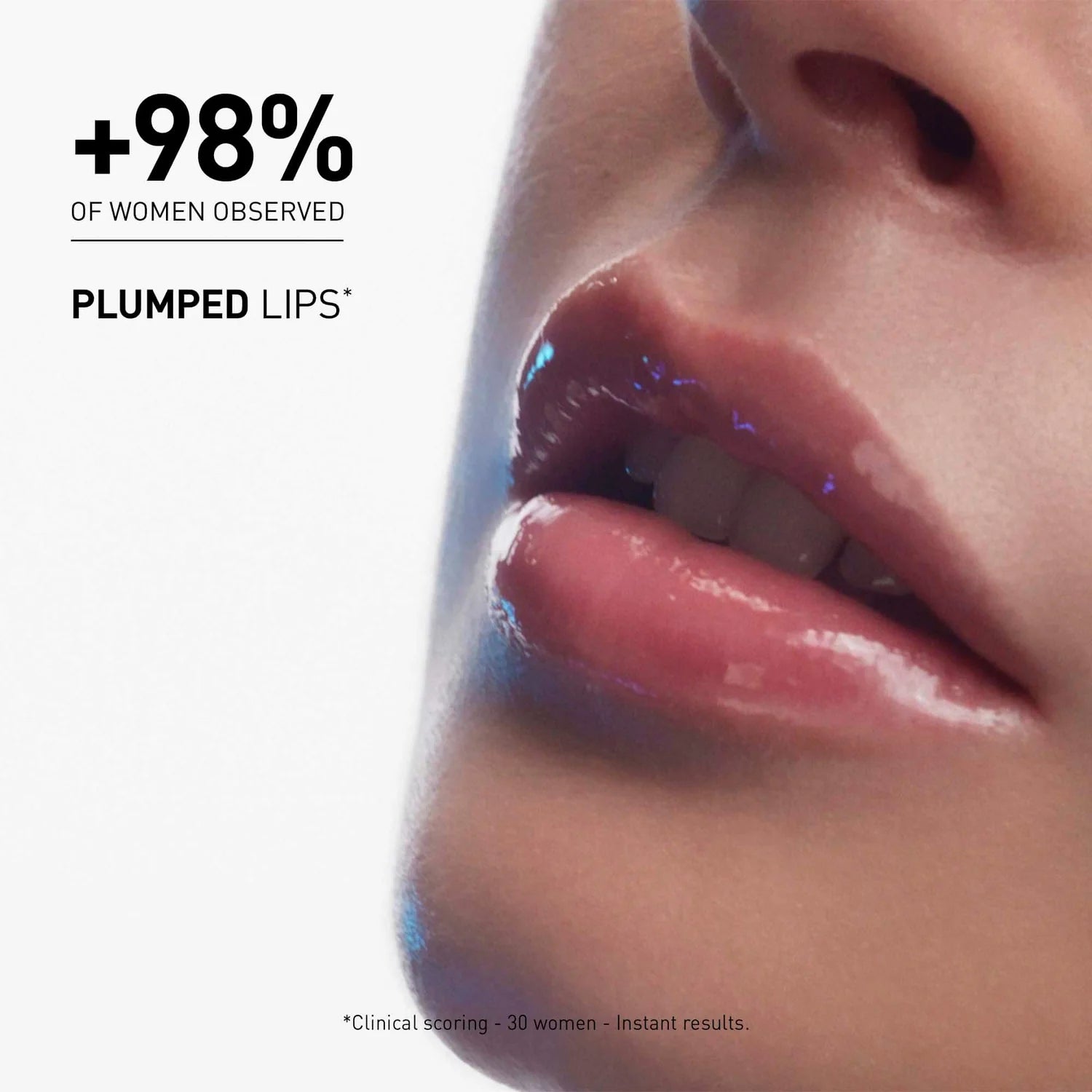 Hyalu Filler Lips