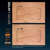 Wrinkles Daily Peel Anti-Wrinkle Resurfacing Solution