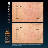 Dark Spots Daily Peel Anti-Dark Spot Resurfacing Solution