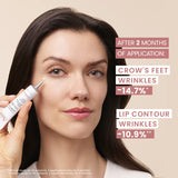 Hyaluron Activ Procedure Retinal 0.05% Retinal Eye & Lip Cream