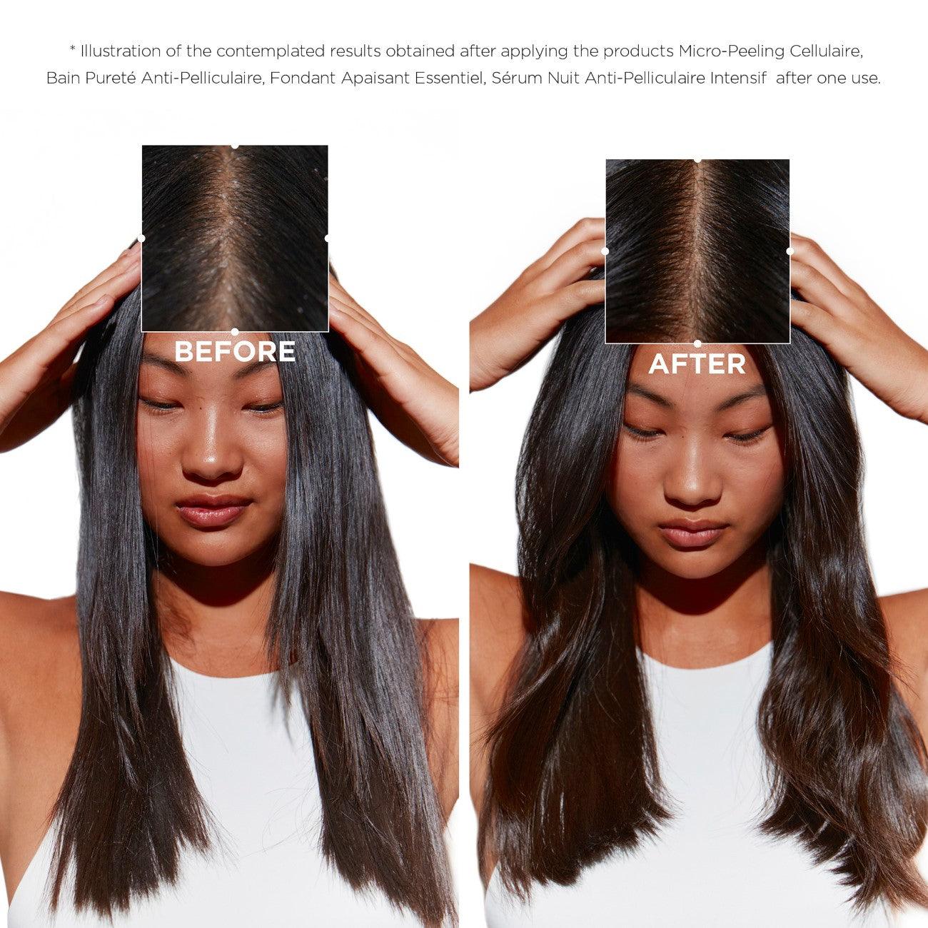 Kérastase Symbiose Purifying Anti-Dandruff Shampoo - Skin Society {{ shop.address.country }}