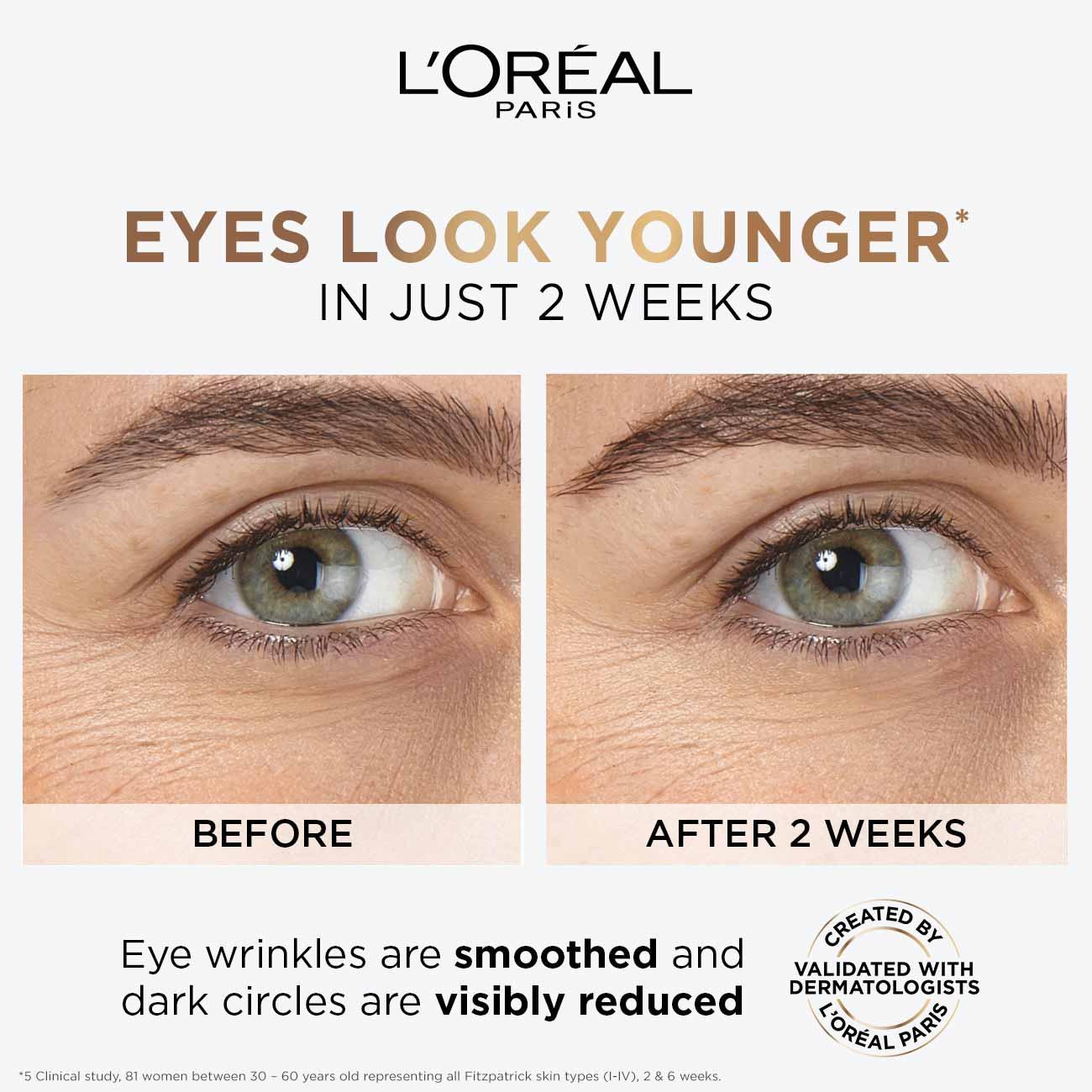 L'Oréal Paris Hyaluron Expert Moisturiser and Anti-Aging Eye Serum with 2.5% Hyaluronic Acid & Caffeine - Skin Society {{ shop.address.country }}