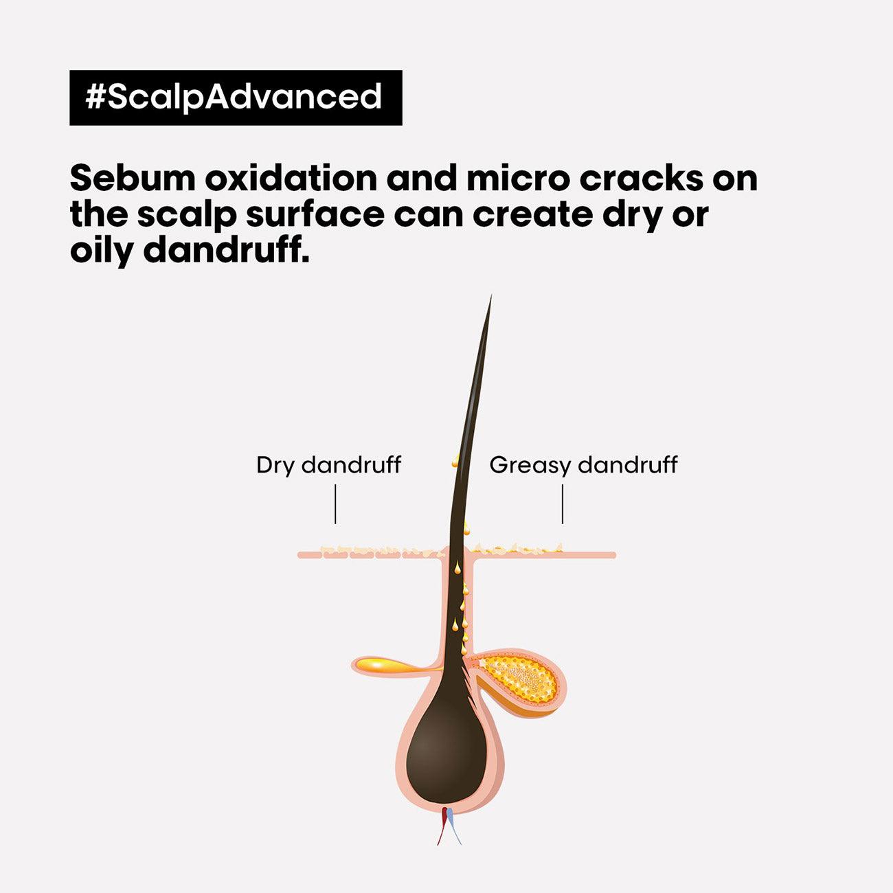 L'Oréal Professionnel Serie Expert Scalp Advanced Anti-Dandruff Dermo-Clarifier Shampoo - Skin Society {{ shop.address.country }}