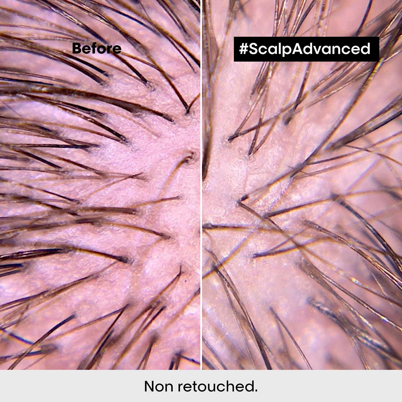 L'Oréal Professionnel Serie Expert Scalp Advanced Anti-Discomfort Dermo-Regulator Shampoo - Skin Society {{ shop.address.country }}