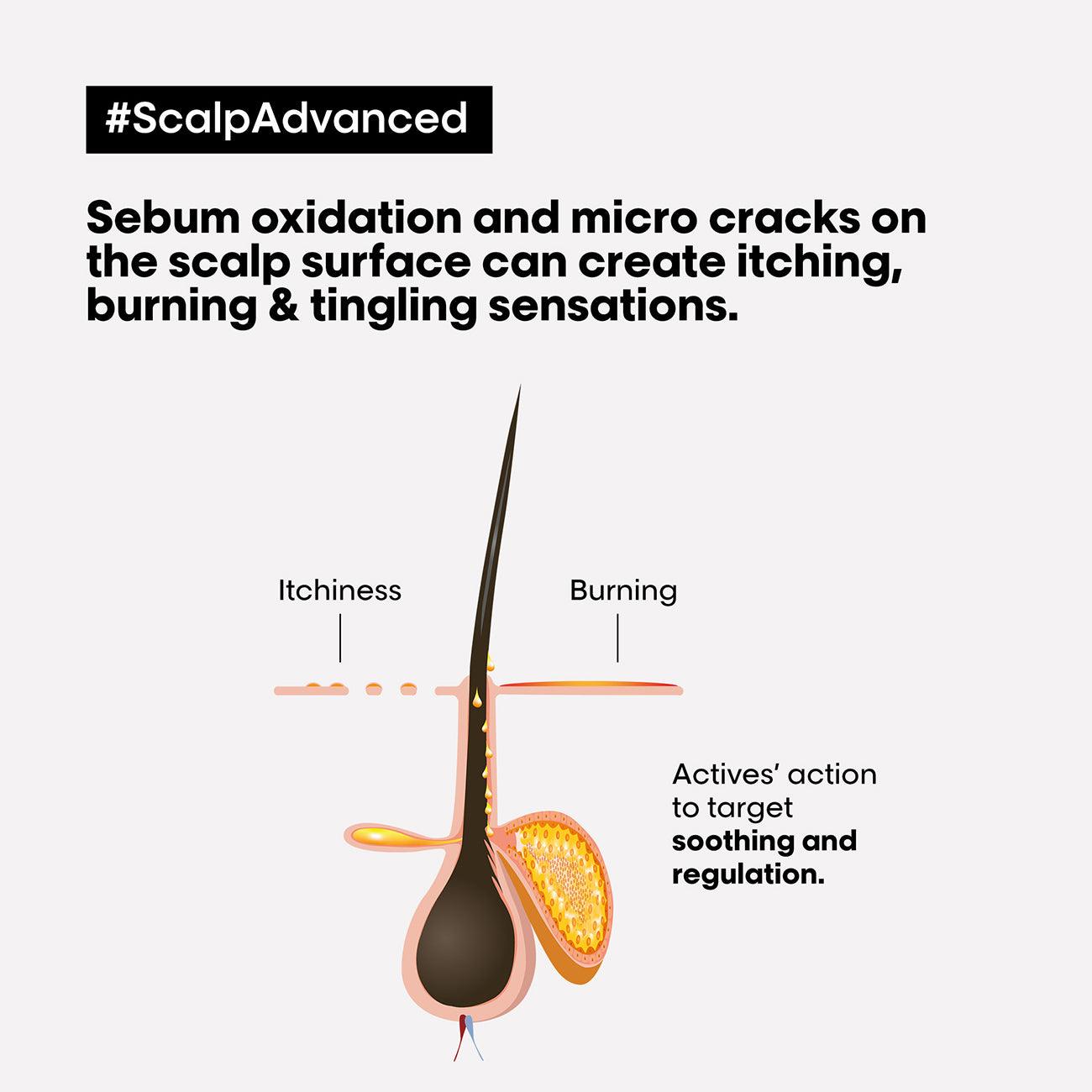 L'Oréal Professionnel Serie Expert Scalp Advanced Anti-Discomfort Intense Soother Treatment - Skin Society {{ shop.address.country }}