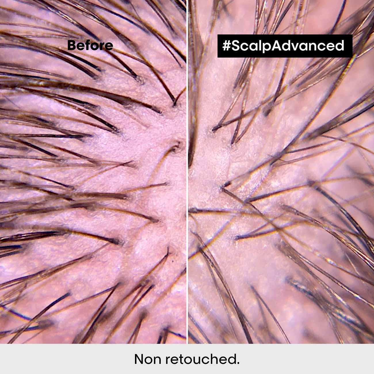 L'Oréal Professionnel Serie Expert Scalp Advanced Anti-Discomfort Intense Soother Treatment - Skin Society {{ shop.address.country }}