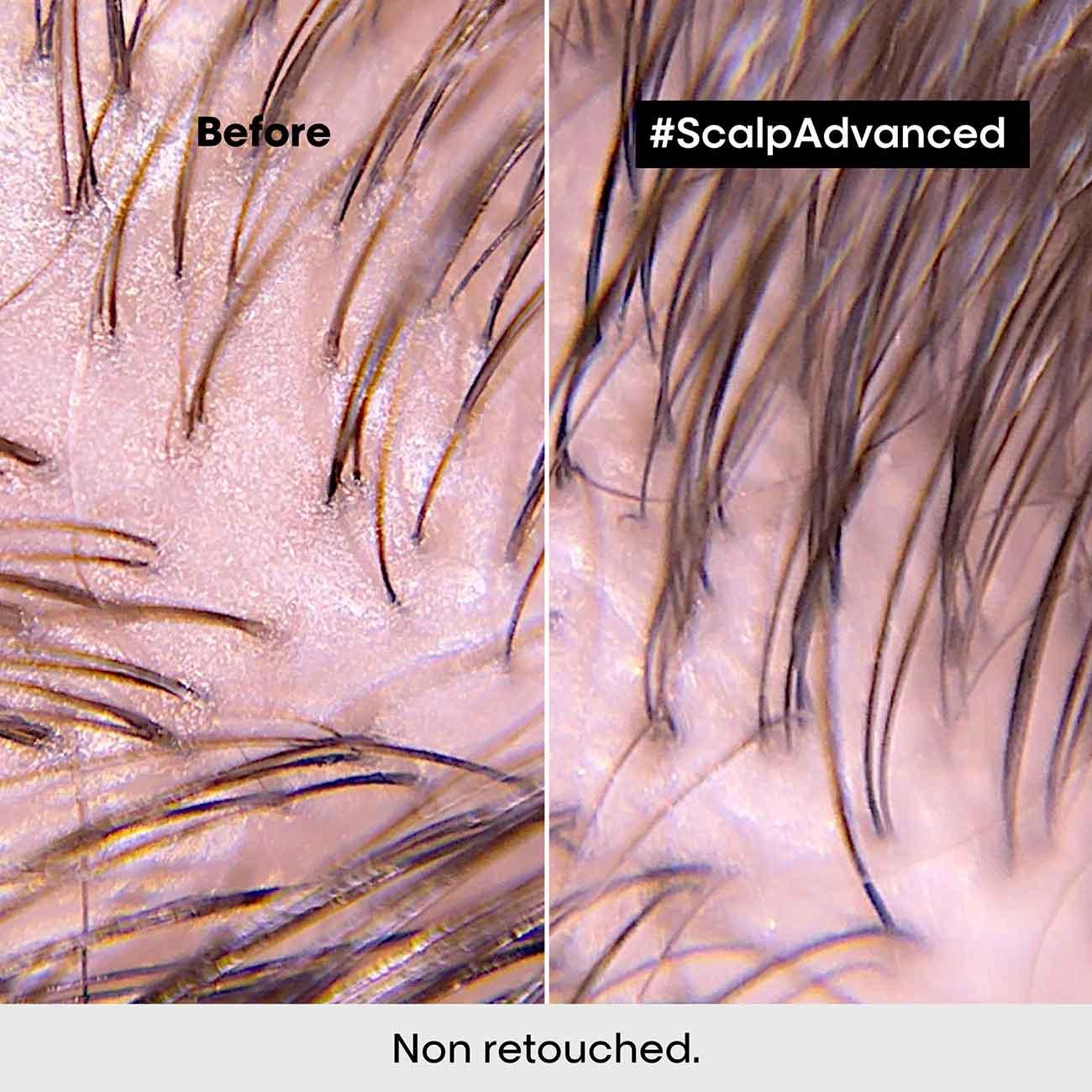 L'Oréal Professionnel Serie Expert Scalp Advanced Anti-Oiliness Dermo-Purifier Shampoo - Skin Society {{ shop.address.country }}