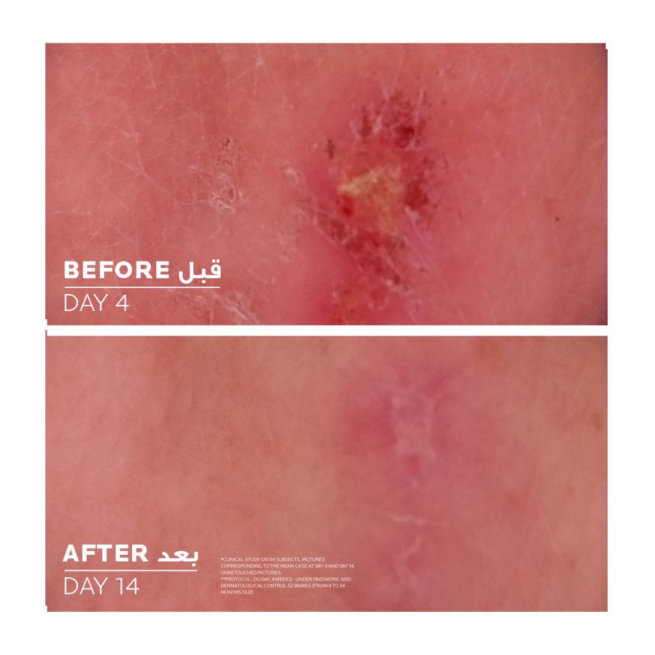 La Roche-Posay Cicaplast Baume B5+ Repairing Balm - Skin Society {{ shop.address.country }}