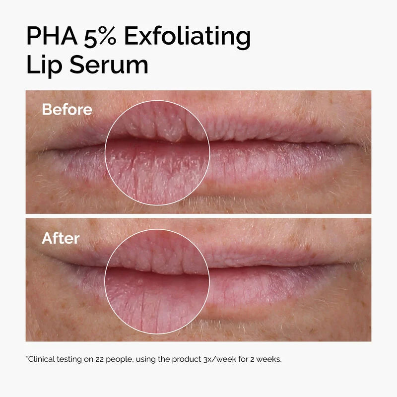 Pha 5% Exfoliating and Hydrating Lip Serum