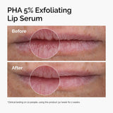 Pha 5% Exfoliating and Hydrating Lip Serum