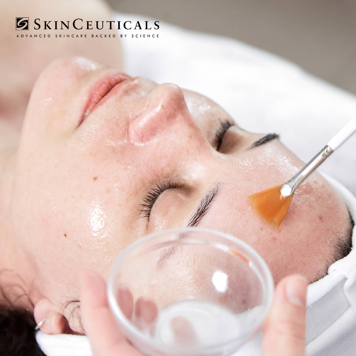 SkinCeuticals Peeling FREE
